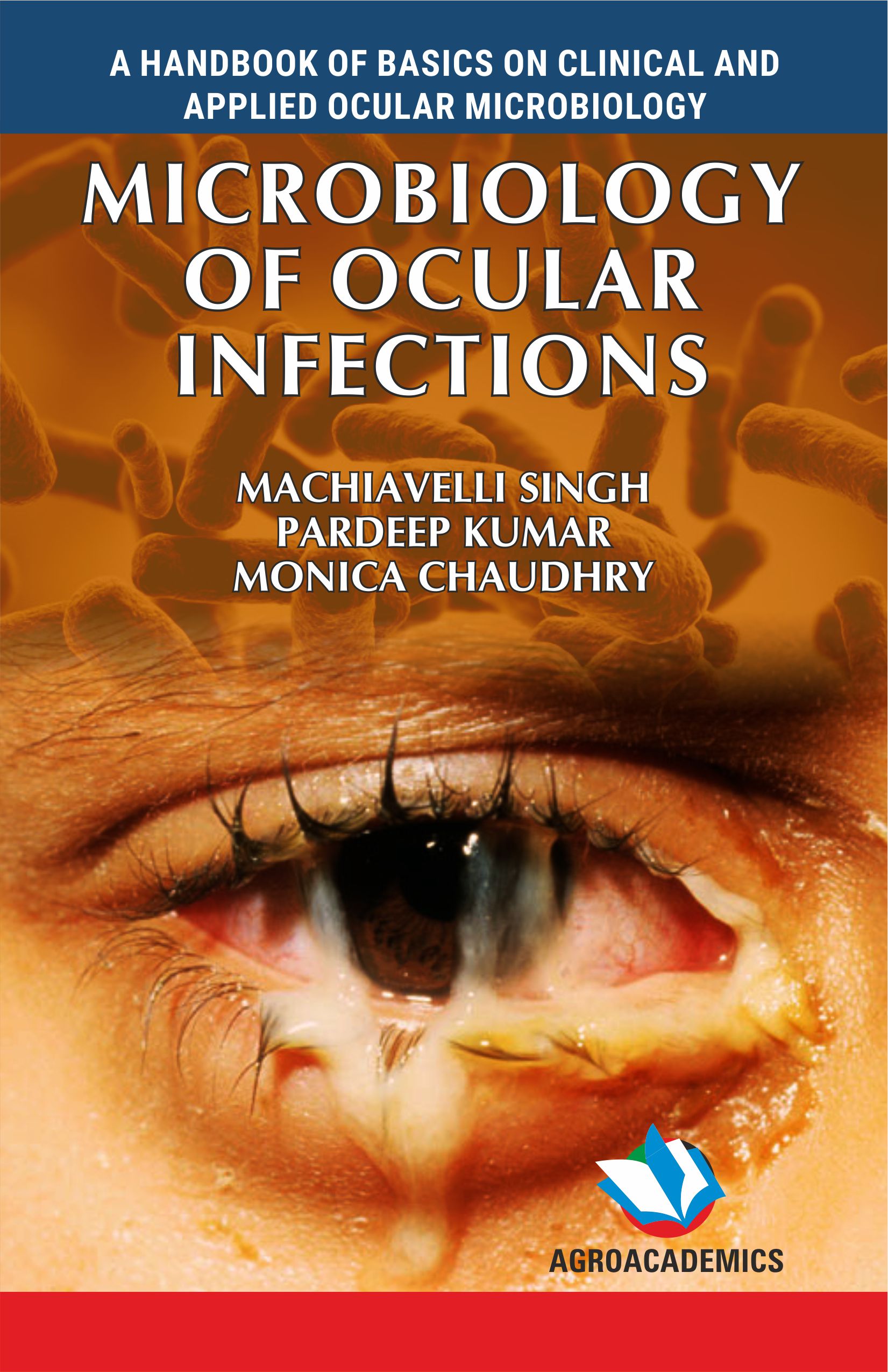 A Textbook On Microbiology Of Ocular Infections